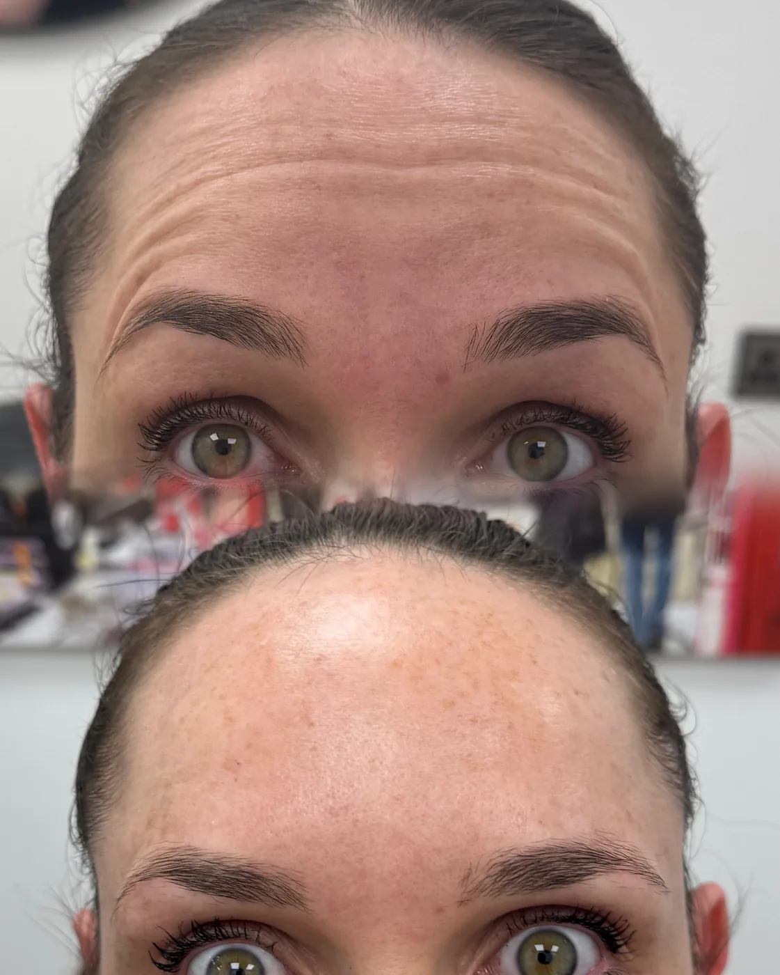 Anti-wrinkle result
