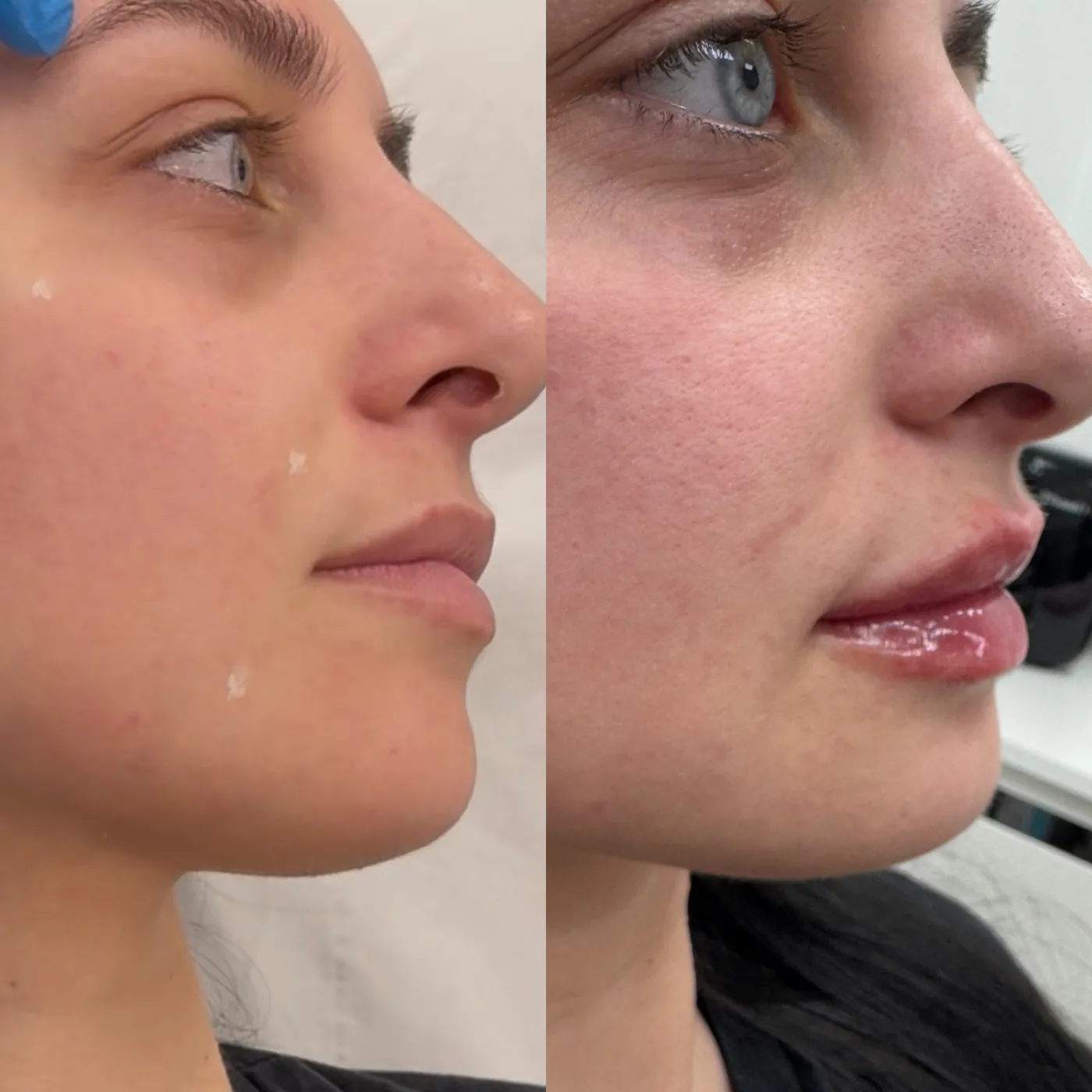 Client result