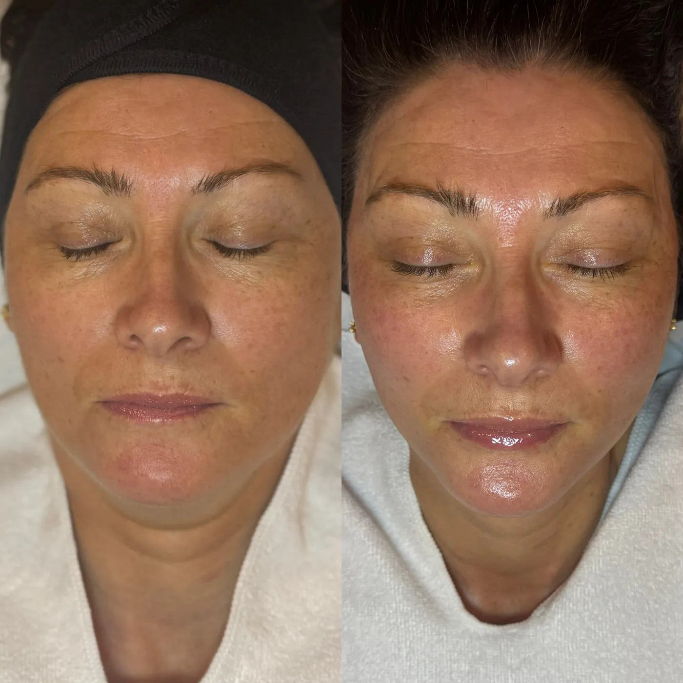 A client result