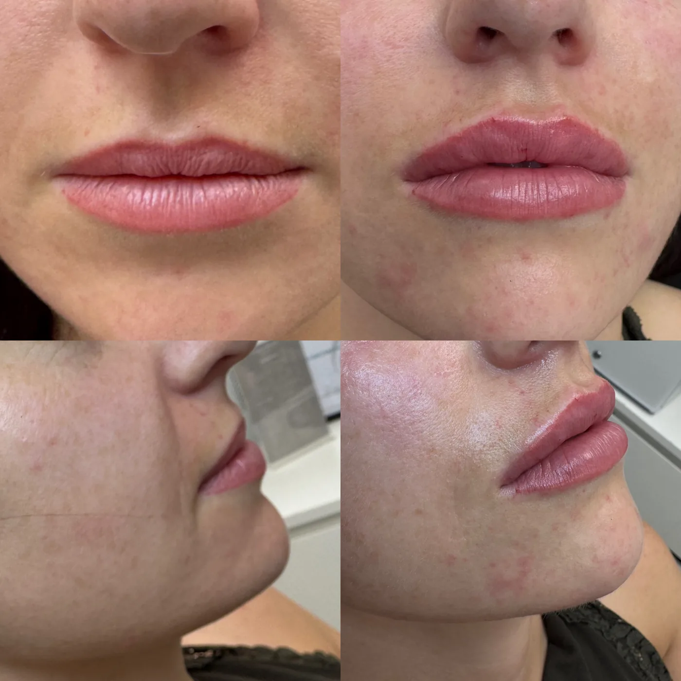 Client result