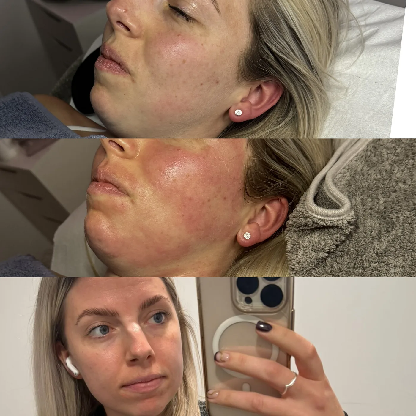 Client result